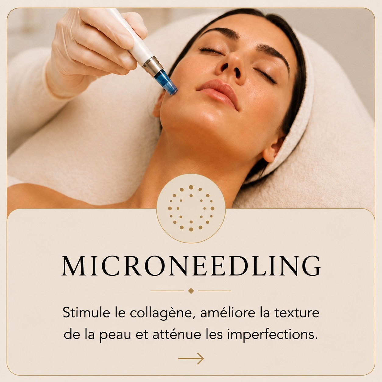 carte microneedling