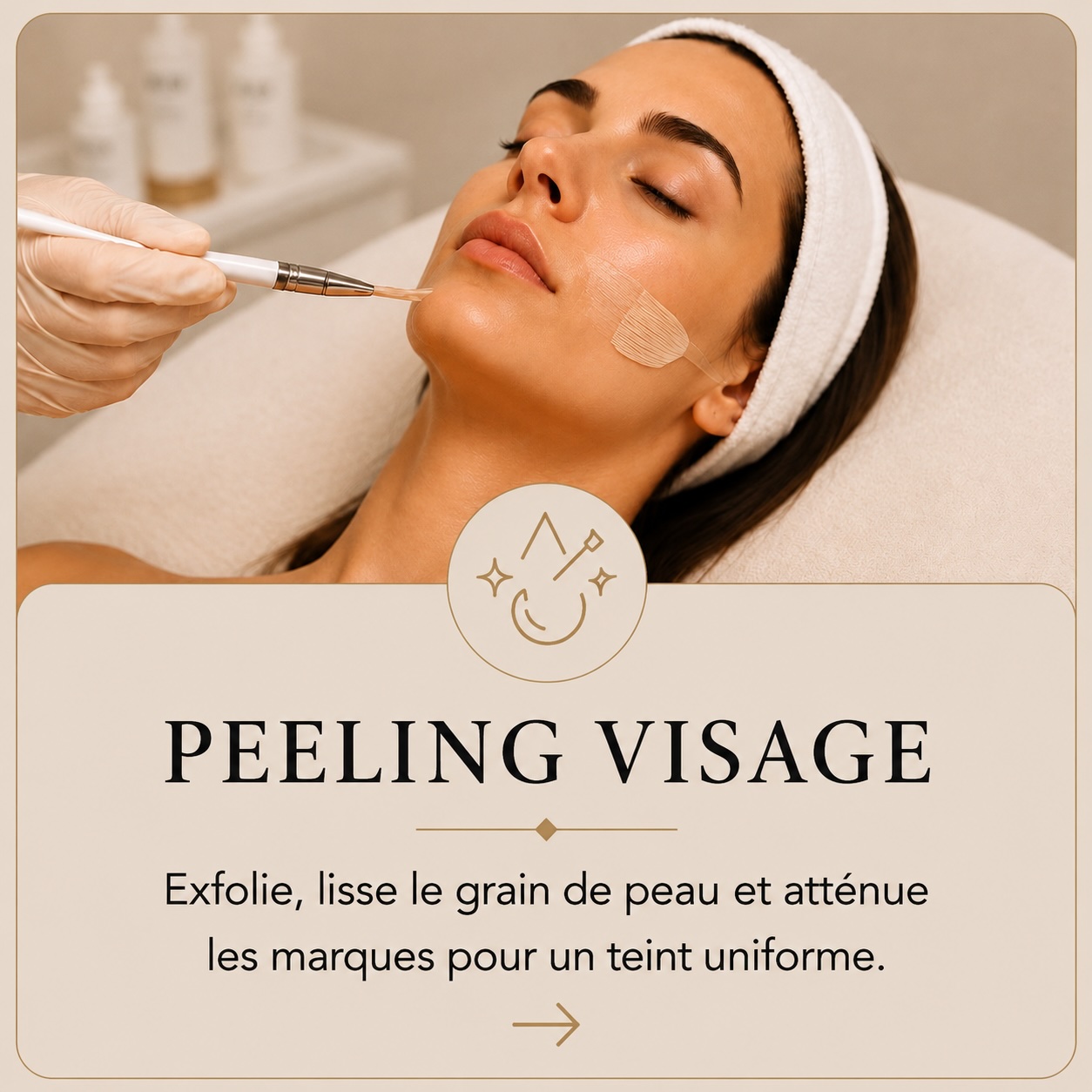 carte peeling