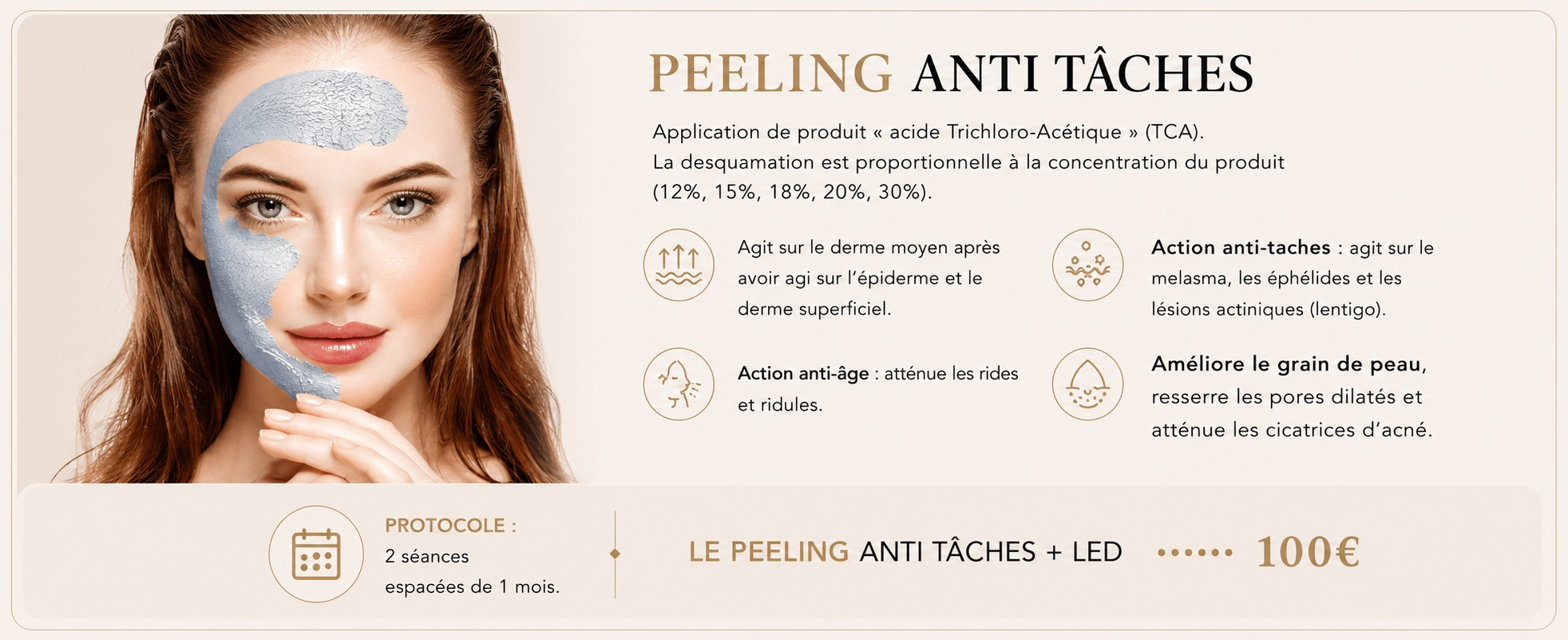 peeling 5