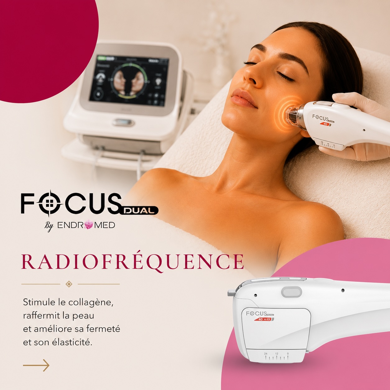 radiofrequence carte