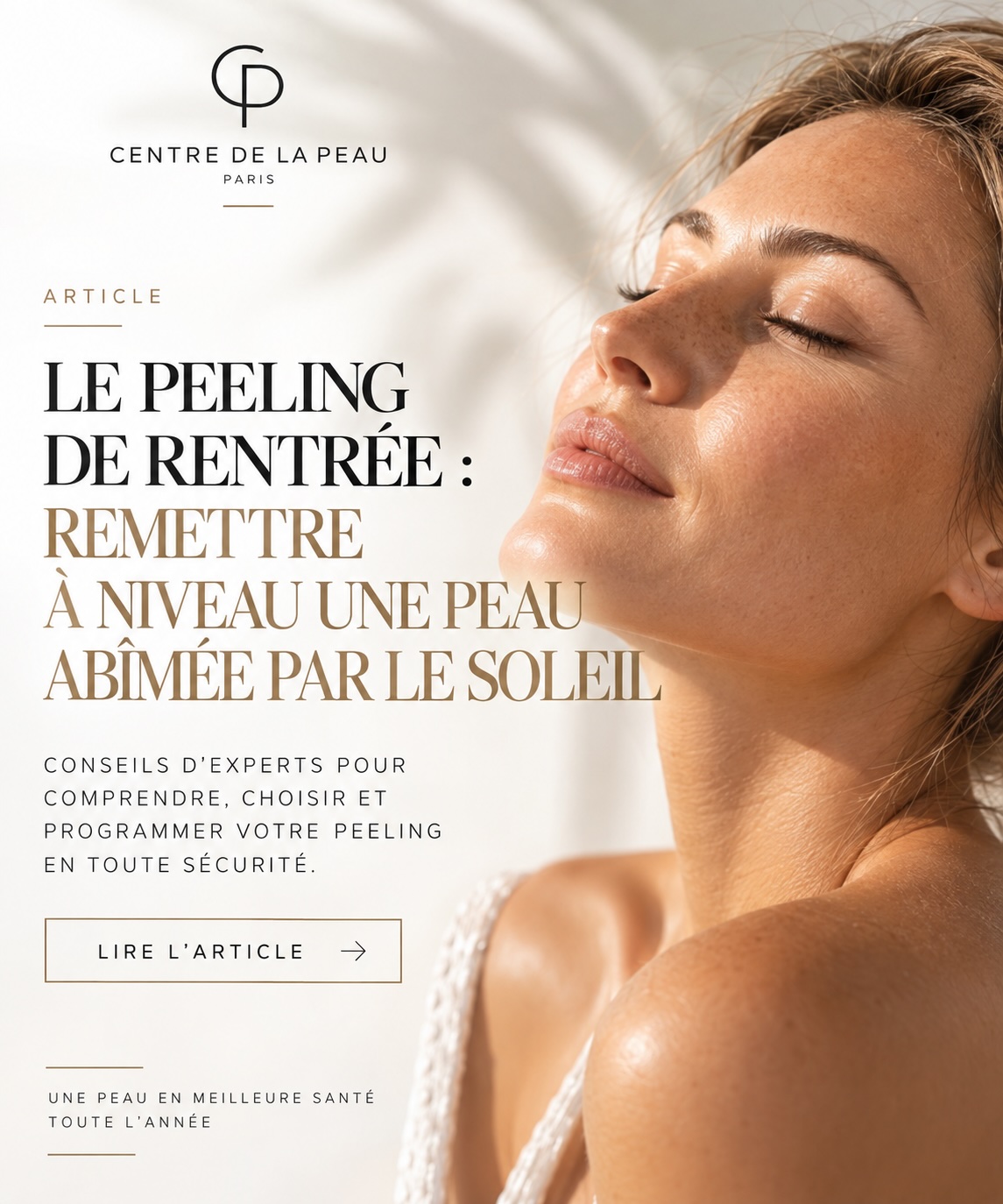 visuel peeling